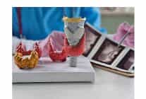 yalanci noduller gereksiz tiroit ameliyatlarina yol acabiliyor