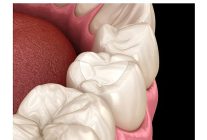 estetik dolgularin omrunu aliskanliklarimiz belirliyor