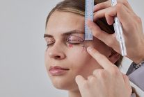 sarkan goz kapaklari estetik bir ihtiyac mi yoksa ciddi bir gorme sorunu mu