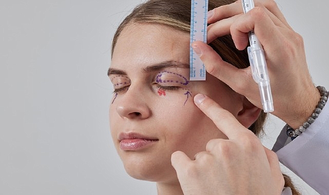 sarkan goz kapaklari estetik bir ihtiyac mi yoksa ciddi bir gorme sorunu mu